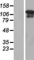 MAGI3 Protein (Over-Expression Lysate Myc-DDK (Flag))
