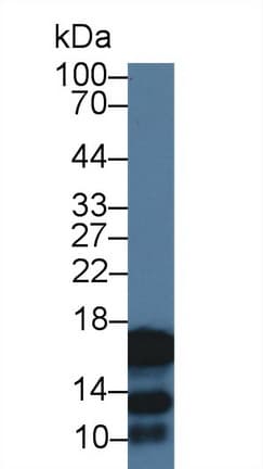 Cystatin SA / CST2 Antibody (aa21-141)