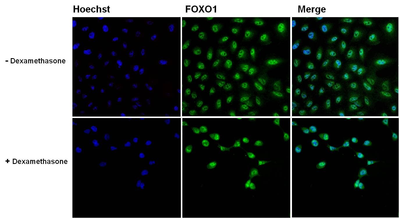 FOXO1 / FKHR Antibody (clone 3B6)