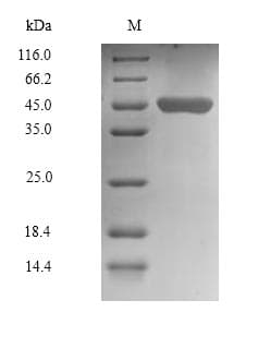 Human CHID1 Protein (Recombinant 6His, N-terminus)