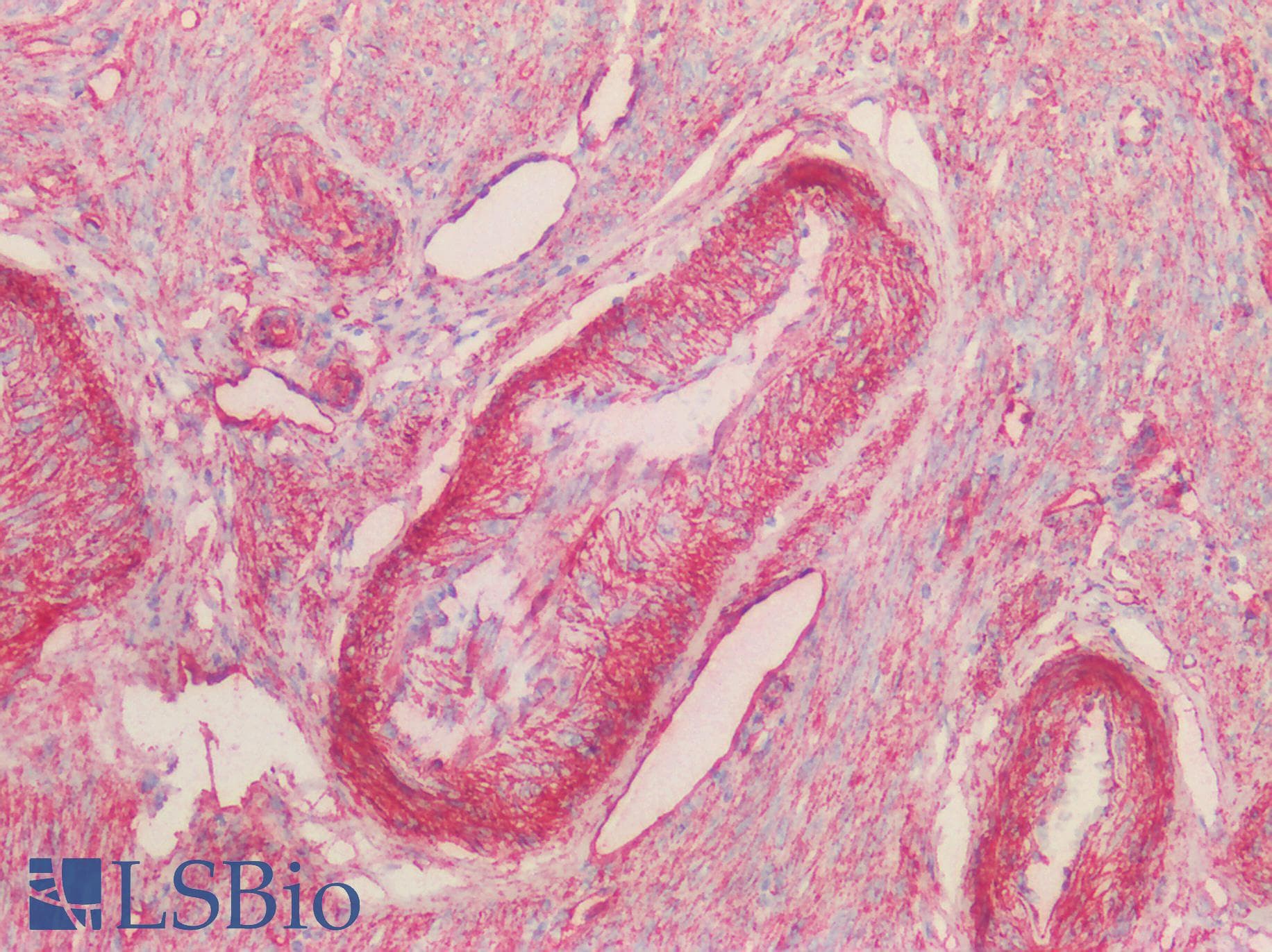 PathPlus™ Polyclonal Goat anti-Human CAV1 / Caveolin 1 Antibody (aa73-84, IHC, IF, WB)