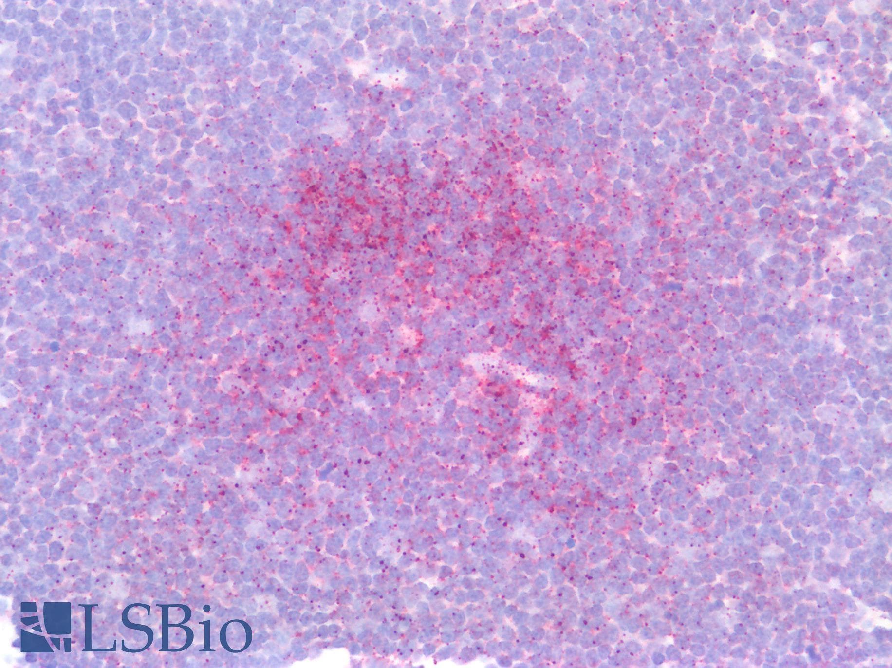 IHC-plus™ Polyclonal Goat anti-Human IRF4 Antibody (Amino Acids 393-407, IHC, WB)