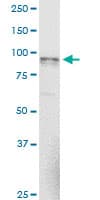 Monoclonal Mouse anti-Human NAGLU Antibody (clone 1B7, WB)