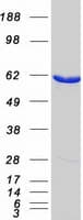 Human MCCC2 / MCCB Protein (Recombinant Myc-DDK (Flag))