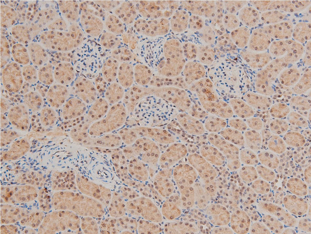 LIMK1 / LIMK Antibody (phospho-Thr508)