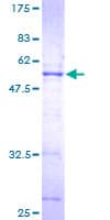 Human SERTAD1 / TRIP-Br1 / SEI-1 Protein (Recombinant GST)