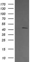 MAP2K1 / MKK1 / MEK1 Antibody (clone OTI7B1)