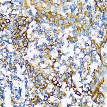 NFKB1 / NF-Kappa-B Antibody