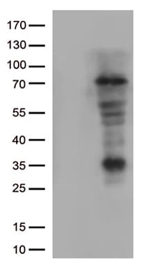 Monoclonal Mouse anti-Human LAG3 Antibody (clone OTI4C11, WB)