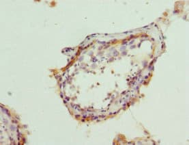 Polyclonal Rabbit anti-Human BAP29 / BCAP29 Antibody (IHC, WB)