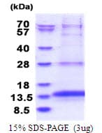 Human OXLD1 / C17orf90 Protein (Recombinant His)
