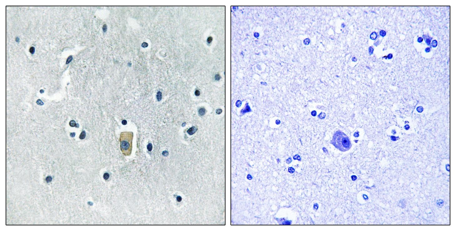 BCL2L11 / BIM Antibody (phospho-Ser59)