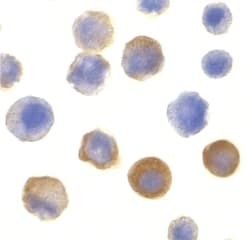 IRAK1 / IRAK Antibody