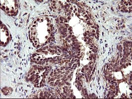 UPRT Antibody (clone OTI3A3, Carrier-free)