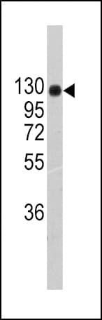 COL2A1 / Collagen II Alpha 1 Antibody (aa1209-1237)