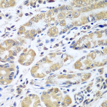 EIF1AX Antibody