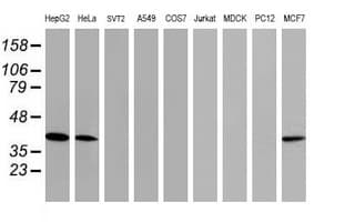 TBCC Antibody (clone OTI2B3)