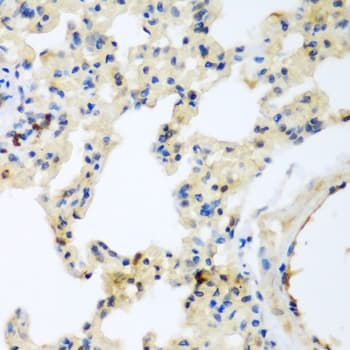 P3H3 / LEPREL2 Antibody