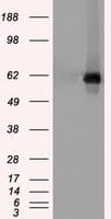 CHEK2 / CHK2 Antibody (clone OTI10G7)