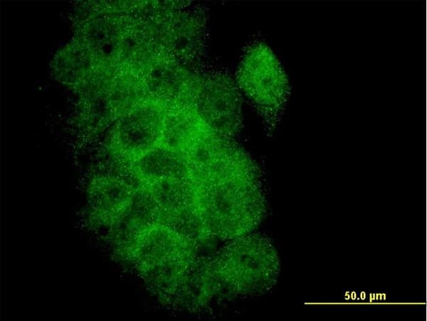 BCL2L1 / BCL-XL Antibody (clone 3E2-2A5)