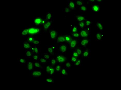 PMS2 Antibody