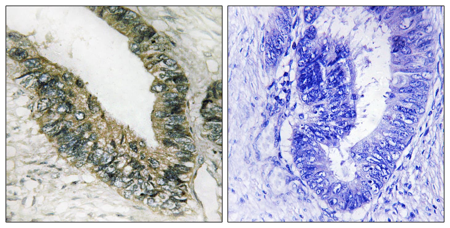 EIF2AK3 / PERK Antibody (aa947-996)