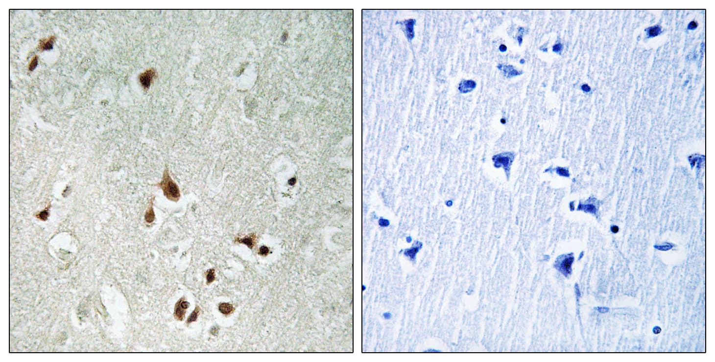 HDAC5 Antibody (Internal)