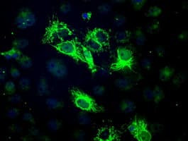 BCKDK Antibody (clone OTI11C9)