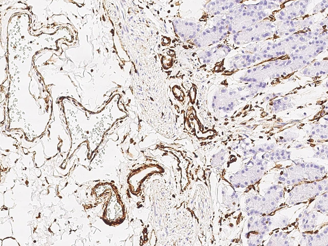 Vimentin Antibody (clone 001, Preservative Free)