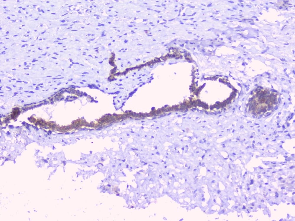 Polyclonal Rabbit anti-Human PTP1B Antibody (IHC, WB)