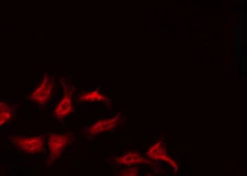 RSAD1 Antibody