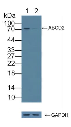 ABCD2 / ALDR Antibody