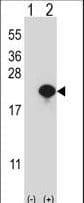 Polyclonal Rabbit anti-Human CYB5A / Cytochrome b5 Antibody (aa69-98, IHC, WB)