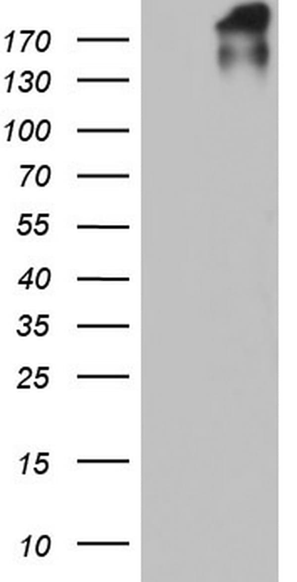 VWF / Von Willebrand Factor Antibody (aa764-1263, clone OTI1H2)