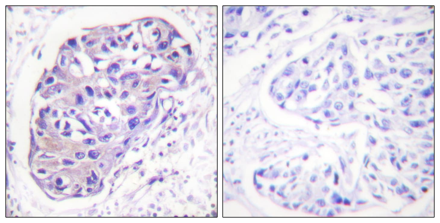 ADRBK1 / GRK2 Antibody (aa14-63)