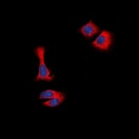 Polyclonal Rabbit anti-Human STMN1 / Stathmin / LAG Antibody (N-Terminus, IHC, IF, WB)