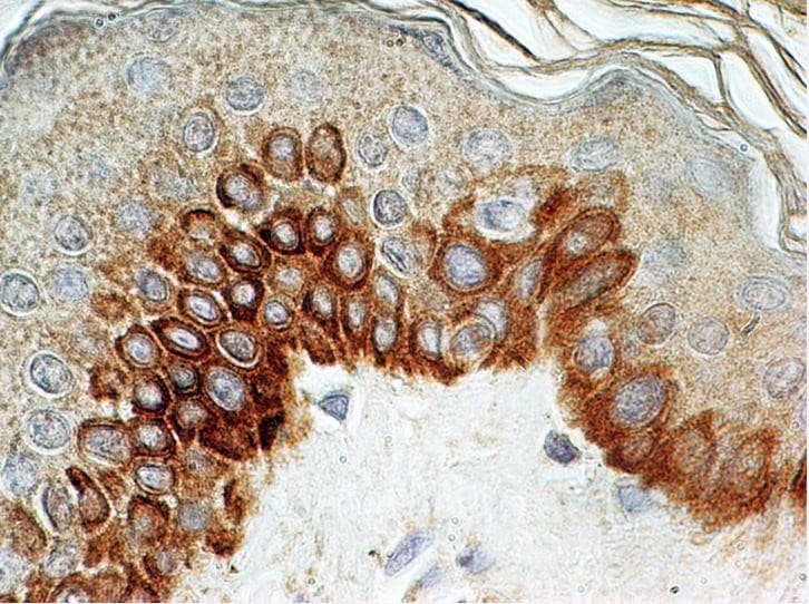 TLR4 Antibody (aa100-200, clone 76B357.1, Azide-free)