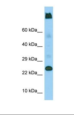 LY6G5C Antibody (C-Terminus)