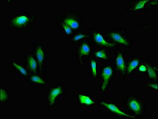 Polyclonal Rabbit anti-Human VAC14 / TRX Antibody (IF)