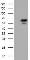 AK5 / Adenylate Kinase 5 Antibody (clone OTI2A2)