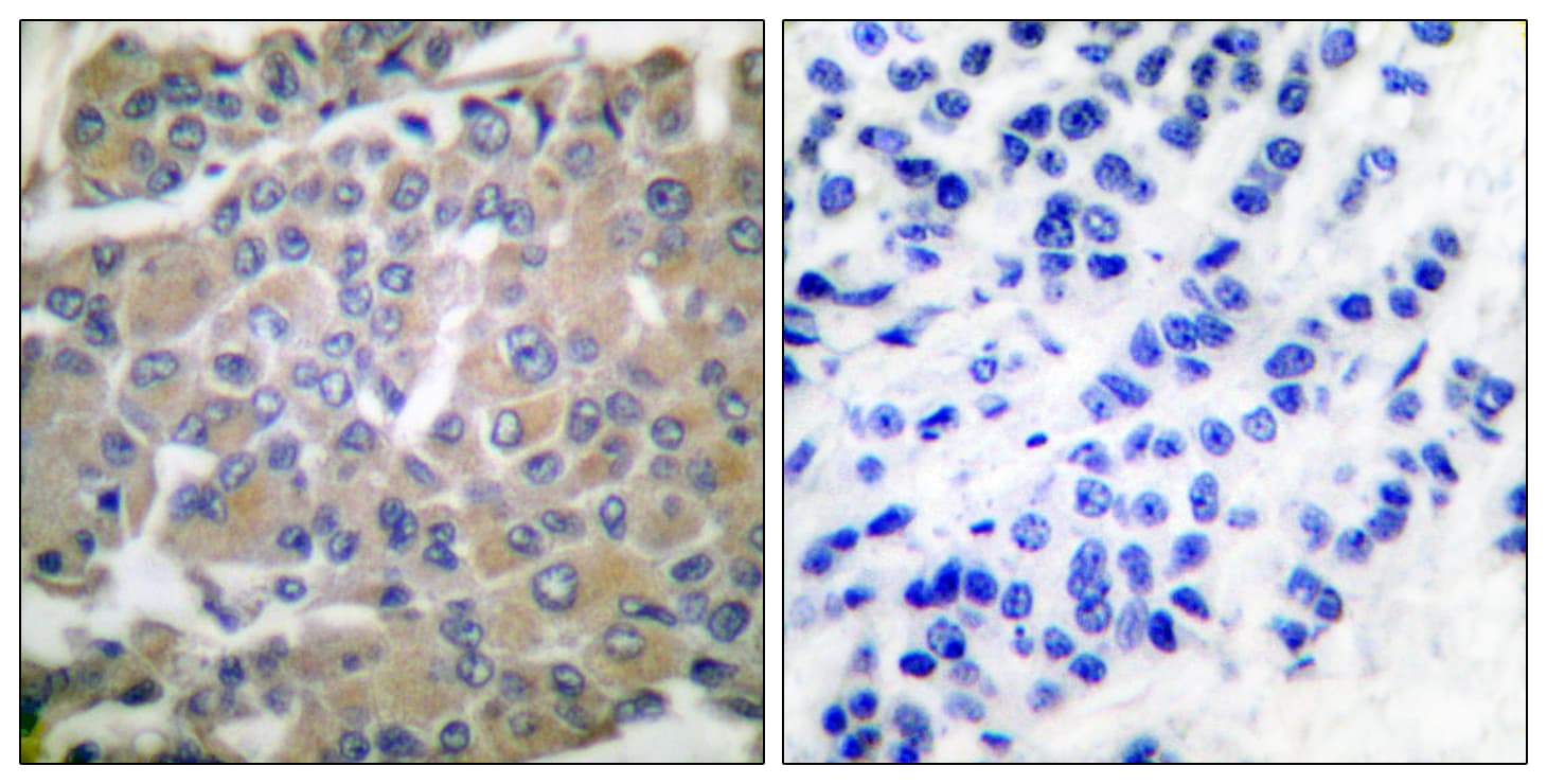Polyclonal Rabbit anti-Human MMP8 Antibody (aa418-467, IHC, WB)