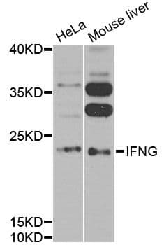 IFN Gamma / Interferon Gamma Antibody
