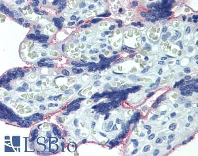 IHC-plus™ Polyclonal Rabbit anti-Human PLA2G2D Antibody (IHC, IF, WB)