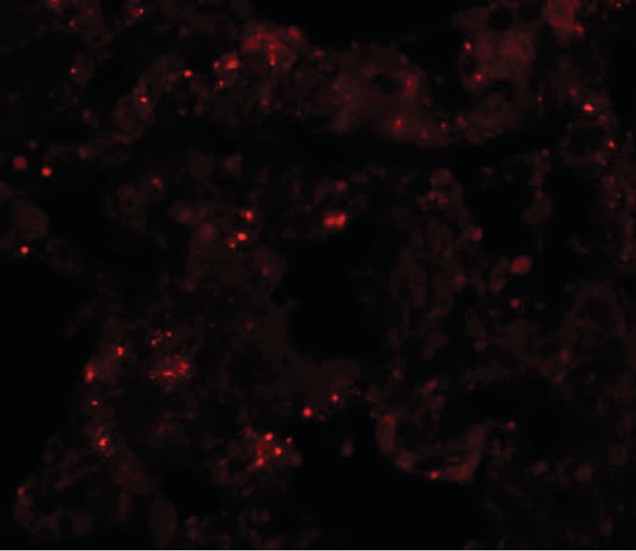 PLEKHM1 Antibody
