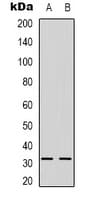 NGF Antibody (Internal)