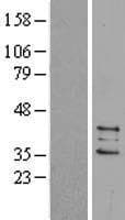 PTGES2 Protein (Over-Expression Lysate Myc-DDK (Flag))