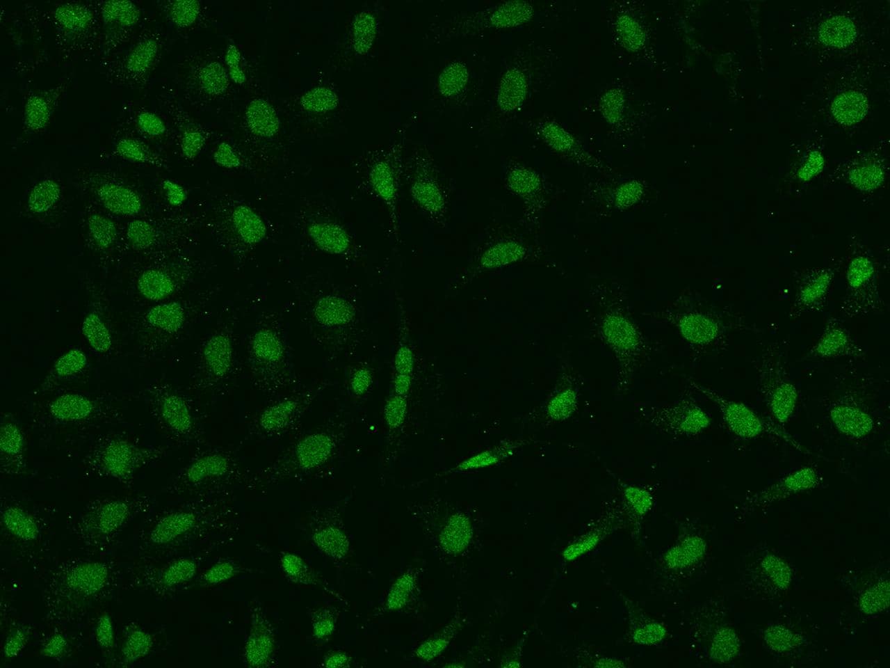 DEK Antibody