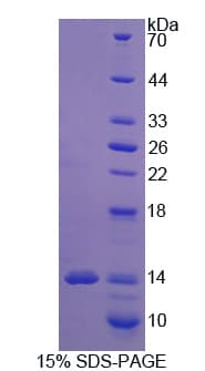 Human SLC1A1 / EAAT3 Protein (Recombinant His)