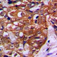 Polyclonal Rabbit anti-Human MVK Antibody (Internal, IHC, IF, WB)