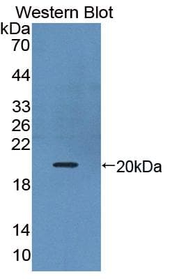 IL17B Antibody (aa21-180)